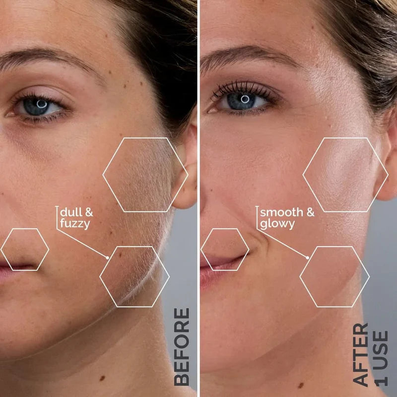 Dermaplaning Tool